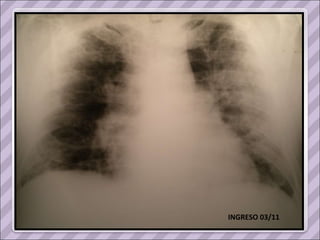 INGRESO 03/11 