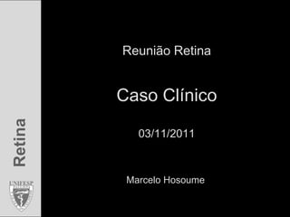 Reunião Retina


         Caso Clínico
Retina




            03/11/2011



          Marcelo Hosoume
 