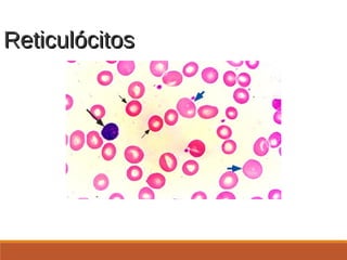 ReticulócitosReticulócitos
http://www.uptodate.com.offcampus.lib.washington.edu/online/content/images/
HEME/9131/Polychromatophilia.jpg
 