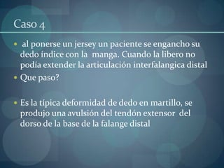 Caso 4 al ponerse un jersey un paciente se engancho su dedo índice con la  manga. Cuando la libero no podía extender la articulación interfalangica distalQue paso?Es la típica deformidad de dedo en martillo, se produjo una avulsión del tendón extensor  del dorso de la base de la falange distal