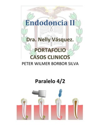 Endodoncia II
Dra. Nelly Vásquez.
PORTAFOLIO
CASOS CLINICOS
PETER WILMER BORBOR SILVA
Paralelo 4/2
 
