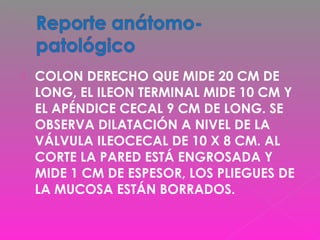  COLON DERECHO QUE MIDE 20 CM DE
LONG, EL ILEON TERMINAL MIDE 10 CM Y
EL APÉNDICE CECAL 9 CM DE LONG. SE
OBSERVA DILATACIÓN A NIVEL DE LA
VÁLVULA ILEOCECAL DE 10 X 8 CM. AL
CORTE LA PARED ESTÁ ENGROSADA Y
MIDE 1 CM DE ESPESOR, LOS PLIEGUES DE
LA MUCOSA ESTÁN BORRADOS.
 