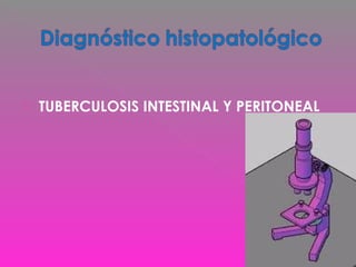  TUBERCULOSIS INTESTINAL Y PERITONEAL
 