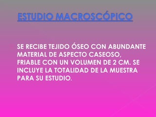  SE RECIBE TEJIDO ÓSEO CON ABUNDANTE
MATERIAL DE ASPECTO CASEOSO,
FRIABLE CON UN VOLUMEN DE 2 CM. SE
INCLUYE LA TOTALIDAD DE LA MUESTRA
PARA SU ESTUDIO.
 