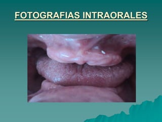 FOTOGRAFIAS INTRAORALES
 