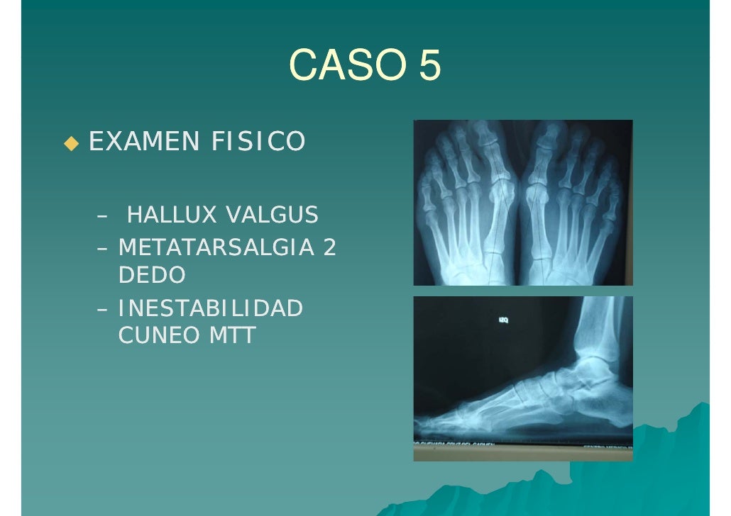 Casos clinicos dolor Casos clinicos dolor