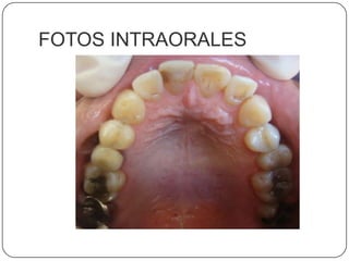 FOTOS INTRAORALES