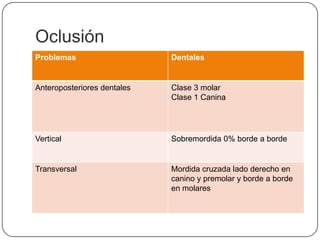 Oclusión 