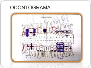 ODONTOGRAMA