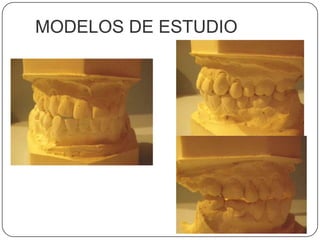MODELOS DE ESTUDIO
