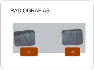 RADIOGRAFÍAS 3828