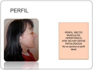 PERFILPERFIL :RECTOMÚSCULOS: HIPERTÓNICOATM: NO HAY DATOS PATOLÓGICOSNo se aprecia el perfil labial 