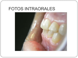 FOTOS INTRAORALES