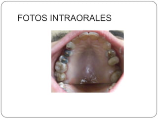 FOTOS INTRAORALES