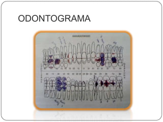 ODONTOGRAMA