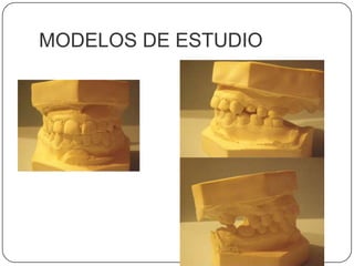 MODELOS DE ESTUDIO
