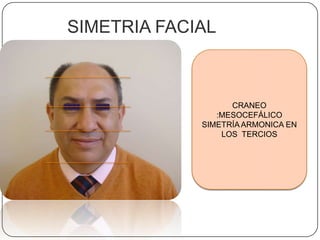 SIMETRIA FACIALCRANEO :MESOCEFÁLICOSIMETRÍA ARMONICA EN LOS  TERCIOS 