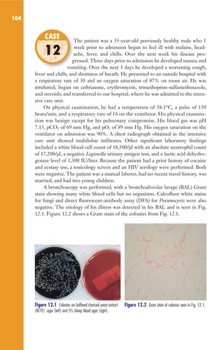 104
The patient was a 35-year-old previously healthy male who 1
week prior to admission began to feel ill with malaise, head-
ache, fever, and chills. Over the next week his disease pro-
gressed. Three days prior to admission he developed nausea and
vomiting. Over the next 3 days he developed a worsening cough,
fever and chills, and shortness of breath. He presented to an outside hospital with
a respiratory rate of 30 and an oxygen saturation of 87% on room air. He was
intubated; begun on ceftriaxone, erythromycin, trimethoprim-sulfamethoxazole,
and steroids; and transferred to our hospital, where he was admitted to the inten-
sive care unit.
On physical examination, he had a temperature of 38.1°C, a pulse of 150
beats/min, and a respiratory rate of 16 on the ventilator. His physical examina-
tion was benign except for his pulmonary compromise. His blood gas was pH
7.13, pCO2 of 69 mm Hg, and pO2 of 89 mm Hg. His oxygen saturation on the
ventilator on admission was 90%. A chest radiograph obtained in the intensive
care unit showed multilobar infiltrates. Other significant laboratory findings
included a white blood cell count of 18,500/µl with an absolute neutrophil count
of 17,200/µl, a negative Legionella urinary antigen test, and a lactic acid dehydro-
genase level of 1,300 IU/liter. Because the patient had a prior history of cocaine
and ecstasy use, a toxicology screen and an HIV serology were performed. Both
were negative. The patient was a manual laborer, had no recent travel history, was
married, and had two young children.
A bronchoscopy was performed, with a bronchoalveolar lavage (BAL) Gram
stain showing many white blood cells but no organisms. Calcofluor white stains
for fungi and direct fluorescent-antibody assay (DFA) for Pneumocystis were also
negative. The etiology of his illness was detected in his BAL and is seen in Fig.
12.1. Figure 12.2 shows a Gram stain of the colonies from Fig. 12.1.
The patient was a 35-year-old previously healthy male who 1
ache, fever, and chills. Over the next week his disease pro-
gressed. Three days prior to admission he developed nausea and
vomiting. Over the next 3 days he developed a worsening cough,
CASE
12
Figure 12.1 Colonies on buffered charcoal yeast extract
(BCYE) agar (left) and 5% sheep blood agar (right).
Figure 12.2 Gram stain of colonies seen in Fig. 12.1.
Gilligan_Sec2_063-156.indd 104 7/24/14 11:43 AM
 