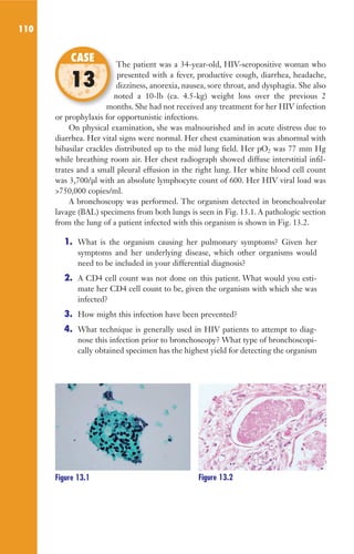 110
The patient was a 34-year-old, HIV-seropositive woman who
presented with a fever, productive cough, diarrhea, headache,
dizziness, anorexia, nausea, sore throat, and dysphagia. She also
noted a 10-lb (ca. 4.5-kg) weight loss over the previous 2
months. She had not received any treatment for her HIV infection
or prophylaxis for opportunistic infections.
On physical examination, she was malnourished and in acute distress due to
diarrhea. Her vital signs were normal. Her chest examination was abnormal with
bibasilar crackles distributed up to the mid lung field. Her pO2 was 77 mm Hg
while breathing room air. Her chest radiograph showed diffuse interstitial infil-
trates and a small pleural effusion in the right lung. Her white blood cell count
was 3,700/µl with an absolute lymphocyte count of 600. Her HIV viral load was
750,000 copies/ml.
A bronchoscopy was performed. The organism detected in bronchoalveolar
lavage (BAL) specimens from both lungs is seen in Fig. 13.1. A pathologic section
from the lung of a patient infected with this organism is shown in Fig. 13.2.
1. What is the organism causing her pulmonary symptoms? Given her
symptoms and her underlying disease, which other organisms would
need to be included in your differential diagnosis?
2. A CD4 cell count was not done on this patient. What would you esti-
mate her CD4 cell count to be, given the organism with which she was
infected?
3. How might this infection have been prevented?
4. What technique is generally used in HIV patients to attempt to diag-
nose this infection prior to bronchoscopy? What type of bronchoscopi-
cally obtained specimen has the highest yield for detecting the organism
The patient was a 34-year-old, HIV-seropositive woman who
dizziness, anorexia, nausea, sore throat, and dysphagia. She also
noted a 10-lb (ca. 4.5-kg) weight loss over the previous 2
months. She had not received any treatment for her HIV infection
CASE
13
Figure 13.1 Figure 13.2
Gilligan_Sec2_063-156.indd 110 7/24/14 11:43 AM
 