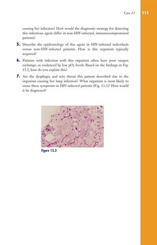 Case 13 111
causing her infection? How would the diagnostic strategy for detecting
this infectious agent differ in non-HIV-infected, immunocompromised
patients?
5. Describe the epidemiology of this agent in HIV-infected individuals
versus non-HIV-infected patients. How is this organism typically
acquired?
6. Patients with infection with this organism often have poor oxygen
exchange, as evidenced by low pO2 levels. Based on the findings in Fig.
13.2, how do you explain this?
7. Are the dysphagia and sore throat this patient described due to the
organism causing her lung infection? What organism is most likely to
cause these symptoms in HIV-infected patients (Fig. 13.3)? How would
it be diagnosed?
Figure 13.3
Gilligan_Sec2_063-156.indd 111 7/24/14 11:43 AM
 