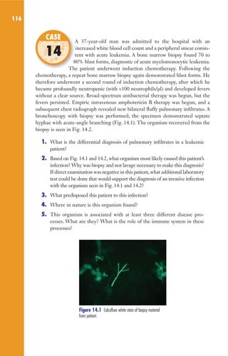 116
A 37-year-old man was admitted to the hospital with an
increased white blood cell count and a peripheral smear consis-
tent with acute leukemia. A bone marrow biopsy found 70 to
80% blast forms, diagnostic of acute myelomonocytic leukemia.
The patient underwent induction chemotherapy. Following the
chemotherapy, a repeat bone marrow biopsy again demonstrated blast forms. He
therefore underwent a second round of induction chemotherapy, after which he
became profoundly neutropenic (with 100 neutrophils/μl) and developed fevers
without a clear source. Broad-spectrum antibacterial therapy was begun, but the
fevers persisted. Empiric intravenous amphotericin B therapy was begun, and a
subsequent chest radiograph revealed new bilateral fluffy pulmonary infiltrates. A
bronchoscopy with biopsy was performed; the specimen demonstrated septate
hyphae with acute-angle branching (Fig. 14.1). The organism recovered from the
biopsy is seen in Fig. 14.2.
1. What is the differential diagnosis of pulmonary infiltrates in a leukemic
patient?
2. Based on Fig. 14.1 and 14.2, what organism most likely caused this patient’s
infection? Why was biopsy and not lavage necessary to make this diagnosis?
If direct examination was negative in this patient, what additional laboratory
test could be done that would support the diagnosis of an invasive infection
with the organism seen in Fig. 14.1 and 14.2?
3. What predisposed this patient to this infection?
4. Where in nature is this organism found?
5. This organism is associated with at least three different disease pro-
cesses. What are they? What is the role of the immune system in these
processes?
A 37-year-old man was admitted to the hospital with an
tent with acute leukemia. A bone marrow biopsy found 70 to
80% blast forms, diagnostic of acute myelomonocytic leukemia.
The patient underwent induction chemotherapy. Following the
CASE
14
Figure 14.1 Calcofluor white stain of biopsy material
from patient.
Gilligan_Sec2_063-156.indd 116 7/24/14 11:43 AM
 