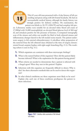 122
This 62-year-old man presented with a 4-day history of left eye
swelling and ptosis along with left frontal headache. He had an
unremarkable medical history, although his family history was
strongly positive for diabetes mellitus. On examination, the
patient was febrile to 38.1°C (100.6°F) and had complete left pto-
sis. Laboratory studies were notable for an elevated white blood cell count of
17,900/µl with 14,400 neutrophils/µl, an elevated blood glucose level of 484 mg/
dl, and urinalysis positive for the presence of ketones. A computed tomography
scan of the sinuses and orbits was notable for fluid in both ethmoid sinuses and
inflammatory changes lateral to the left medial rectus muscle. The patient under-
went surgery (a left external ethmoidectomy). A calcofluor white preparation of
the material from the left ethmoid sinus obtained at the time of surgery demon-
strated broad, aseptate hyphae with right-angle branching (Fig. 15.1). The result-
ing culture is seen in Fig. 15.2.
1. Which organisms are consistent with these microscopic findings?
2. What is the natural habitat of this organism? How did this patient likely
become infected? What is the explanation for this patient having ptosis?
3. What criteria are needed to demonstrate that a patient is infected with
a fungal agent? Were they met in this patient? Explain.
4. Infections with this organism are frequently difficult to detect. Why is
this? Are there alternative methods that can be used to detect this organ-
ism?
5. In what clinical conditions are these organisms most likely to be seen?
Explain why each one of these conditions predisposes the patient to
those infections.
This 62-year-old man presented with a 4-day history of left eye
unremarkable medical history, although his family history was
strongly positive for diabetes mellitus. On examination, the
patient was febrile to 38.1°C (100.6°F) and had complete left pto-
CASE
15
Figure 15.1 Calcofluor white examination of left ethmoid
sinus biopsy.
Gilligan_Sec2_063-156.indd 122 7/24/14 11:43 AM
 