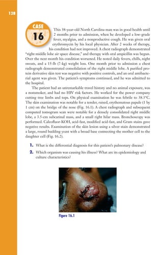 128
This 38-year-old North Carolina man was in good health until
2 months prior to admission, when he developed a low-grade
fever, myalgias, and a nonproductive cough. He was given oral
erythromycin by his local physician. After 2 weeks of therapy,
his condition had not improved. A chest radiograph demonstrated
“right middle lobe air space disease,” and therapy with oral ampicillin was begun.
Over the next month his condition worsened. He noted daily fevers, chills, night
sweats, and a 15-lb (7-kg) weight loss. One month prior to admission a chest
radiograph demonstrated consolidation of the right middle lobe. A purified pro-
tein derivative skin test was negative with positive controls, and an oral antibacte-
rial agent was given. The patient’s symptoms continued, and he was admitted to
the hospital.
The patient had an unremarkable travel history and no animal exposure, was
a nonsmoker, and had no HIV risk factors. He worked for the power company
cutting tree limbs and tops. On physical examination he was febrile to 38.3°C.
The skin examination was notable for a tender, raised, erythematous papule (1 by
1 cm) on the bridge of the nose (Fig. 16.1). A chest radiograph and subsequent
computed tomogram scan were notable for a densely consolidated right middle
lobe, a 3.5-cm subcarinal mass, and a small right hilar mass. Bronchoscopy was
performed. Calcofluor-KOH, acid-fast, modified acid-fast, and Gram stains gave
negative results. Examination of the skin lesion using a silver stain demonstrated
a large, round budding yeast with a broad base connecting the mother cell to the
daughter cell (Fig. 16.2).
1. What is the differential diagnosis for this patient’s pulmonary disease?
2. Which organism was causing his illness? What are its epidemiology and
culture characteristics?
This 38-year-old North Carolina man was in good health until
fever, myalgias, and a nonproductive cough. He was given oral
erythromycin by his local physician. After 2 weeks of therapy,
his condition had not improved. A chest radiograph demonstrated
CASE
16
Figure 16.1
Gilligan_Sec2_063-156.indd 128 7/24/14 11:43 AM
 