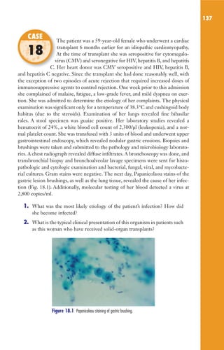 137
The patient was a 59-year-old female who underwent a cardiac
transplant 6 months earlier for an idiopathic cardiomyopathy.
At the time of transplant she was seropositive for cytomegalo-
virus (CMV) and seronegative for HIV, hepatitis B, and hepatitis
C. Her heart donor was CMV seropositive and HIV, hepatitis B,
and hepatitis C negative. Since the transplant she had done reasonably well, with
the exception of two episodes of acute rejection that required increased doses of
immunosuppressive agents to control rejection. One week prior to this admission
she complained of malaise, fatigue, a low-grade fever, and mild dyspnea on exer-
tion. She was admitted to determine the etiology of her complaints. The physical
examination was significant only for a temperature of 38.3°C and cushingoid body
habitus (due to the steroids). Examination of her lungs revealed fine bibasilar
rales. A stool specimen was guaiac positive. Her laboratory studies revealed a
hematocrit of 24%, a white blood cell count of 2,300/µl (leukopenia), and a nor-
mal platelet count. She was transfused with 3 units of blood and underwent upper
gastrointestinal endoscopy, which revealed nodular gastric erosions. Biopsies and
brushings were taken and submitted to the pathology and microbiology laborato-
ries. A chest radiograph revealed diffuse infiltrates. A bronchoscopy was done, and
transbronchial biopsy and bronchoalveolar lavage specimens were sent for histo-
pathologic and cytologic examination and bacterial, fungal, viral, and mycobacte-
rial cultures. Gram stains were negative. The next day, Papanicolaou stains of the
gastric lesion brushings, as well as the lung tissue, revealed the cause of her infec-
tion (Fig. 18.1). Additionally, molecular testing of her blood detected a virus at
2,800 copies/ml.
1. What was the most likely etiology of the patient’s infection? How did
she become infected?
2. What is the typical clinical presentation of this organism in patients such
as this woman who have received solid-organ transplants?
The patient was a 59-year-old female who underwent a cardiac
At the time of transplant she was seropositive for cytomegalo-
virus (CMV) and seronegative for HIV, hepatitis B, and hepatitis
C. Her heart donor was CMV seropositive and HIV, hepatitis B,
CASE
18
Figure 18.1 Papanicolaou staining of gastric brushing.
Gilligan_Sec2_063-156.indd 137 7/24/14 11:43 AM
 