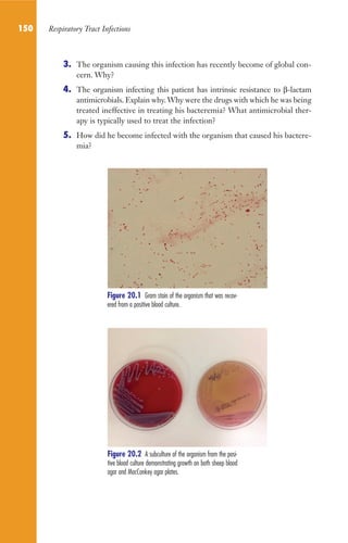 150 Respiratory Tract Infections
3. The organism causing this infection has recently become of global con-
cern. Why?
4. The organism infecting this patient has intrinsic resistance to β-lactam
antimicrobials. Explain why.Why were the drugs with which he was being
treated ineffective in treating his bacteremia? What antimicrobial ther-
apy is typically used to treat the infection?
5. How did he become infected with the organism that caused his bactere-
mia?
Figure 20.2 A subculture of the organism from the posi-
tive blood culture demonstrating growth on both sheep blood
agar and MacConkey agar plates.
Figure 20.1 Gram stain of the organism that was recov-
ered from a positive blood culture.
Gilligan_Sec2_063-156.indd 150 7/24/14 11:43 AM
 