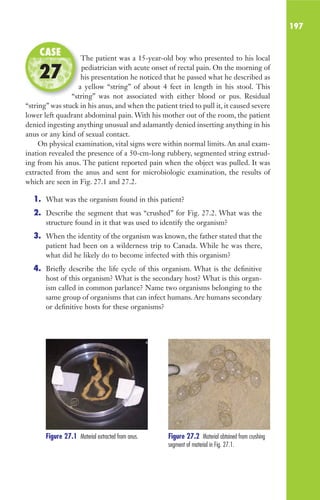 197
The patient was a 15-year-old boy who presented to his local
pediatrician with acute onset of rectal pain. On the morning of
his presentation he noticed that he passed what he described as
a yellow “string” of about 4 feet in length in his stool. This
“string” was not associated with either blood or pus. Residual
“string” was stuck in his anus, and when the patient tried to pull it, it caused severe
lower left quadrant abdominal pain. With his mother out of the room, the patient
denied ingesting anything unusual and adamantly denied inserting anything in his
anus or any kind of sexual contact.
On physical examination, vital signs were within normal limits. An anal exam-
ination revealed the presence of a 50-cm-long rubbery, segmented string extrud-
ing from his anus. The patient reported pain when the object was pulled. It was
extracted from the anus and sent for microbiologic examination, the results of
which are seen in Fig. 27.1 and 27.2.
1. What was the organism found in this patient?
2. Describe the segment that was “crushed” for Fig. 27.2. What was the
structure found in it that was used to identify the organism?
3. When the identity of the organism was known, the father stated that the
patient had been on a wilderness trip to Canada. While he was there,
what did he likely do to become infected with this organism?
4. Briefly describe the life cycle of this organism. What is the definitive
host of this organism? What is the secondary host? What is this organ-
ism called in common parlance? Name two organisms belonging to the
same group of organisms that can infect humans. Are humans secondary
or definitive hosts for these organisms?
The patient was a 15-year-old boy who presented to his local
his presentation he noticed that he passed what he described as
a yellow “string” of about 4 feet in length in his stool. This
“string” was not associated with either blood or pus. Residual
CASE
27
Figure 27.1 Material extracted from anus. Figure 27.2 Material obtained from crushing
segment of material in Fig. 27.1.
Gilligan_Sec3_157-254.indd 197 7/24/14 11:44 AM
 