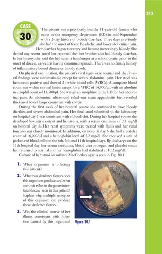 213
The patient was a previously healthy 11-year-old female who
came to the emergency department (ED) in mid-September
with a 2-day history of bloody diarrhea. Three days previously
she had the onset of fever, headache, and lower abdominal pain.
Her diarrhea began as watery and became increasingly bloody. She
denied any recent travel but reported that her brother also had bloody diarrhea.
In her history, she said she had eaten a hamburger at a school picnic prior to the
onset of disease, as well as having consumed spinach. There was no family history
of inflammatory bowel disease or bloody stools.
On physical examination, the patient’s vital signs were normal and the physi-
cal findings were unremarkable except for severe abdominal pain. Her stool was
hemoccult positive and showed 2+ white blood cells (WBCs). A complete blood
count was within normal limits except for a WBC of 14,900/μl, with an absolute
neutrophil count of 13,500/μl. She was given morphine in the ED for her abdom-
inal pain. An abdominal ultrasound ruled out acute appendicitis but revealed
thickened bowel loops consistent with colitis.
During the first week of her hospital course she continued to have bloody
diarrhea and severe abdominal pain. Her final stool submitted to the laboratory
on hospital day 7 was consistent with a blood clot. During her hospital course she
developed low urine output and hematuria, with a serum creatinine of 2.1 mg/dl
on hospital day 5. Her renal symptoms were treated with fluids and her renal
function was closely monitored. In addition, on hospital day 6 she had a platelet
count of 16,000/μl and a hemoglobin level of 7.2 mg/dl. She received a unit of
packed red blood cells on the 6th, 7th, and 11th hospital days. By discharge on the
13th hospital day her serum creatinine, blood urea nitrogen, and platelet count
had returned to normal and her hemoglobin had stabilized at 10.2 mg/dl.
Culture of her stool on sorbitol MacConkey agar is seen in Fig. 30.1.
1. What organism is infecting
this patient?
2. What two virulence factors does
this organism produce, and what
are their roles in the gastrointes-
tinal disease seen in this patient?
Explain why multiple serotypes
of this organism can produce
these virulence factors.
3. Was the clinical course of her
illness consistent with infec-
tion caused by this organism?
The patient was a previously healthy 11-year-old female who
with a 2-day history of bloody diarrhea. Three days previously
she had the onset of fever, headache, and lower abdominal pain.
Her diarrhea began as watery and became increasingly bloody. She
CASE
30
Figure 30.1
Gilligan_Sec3_157-254.indd 213 7/24/14 11:44 AM
 