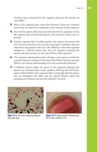 Case 31 221
virulence factor produced by the organism infecting this patient can
cause DIC?
3. What is the organism that caused this infection? Name two virulence
factors that are believed to contribute to the virulence of this organism.
4. How did the patient likely become infected with this organism? Given
the organism that infected this patient, is the outcome in this case sur-
prising?
5. Another organism that is oxidase positive and a glucose fermenter (but
not a lactose fermenter) can cause the same type of syndrome that was
observed in the patient in this case. The difference is that this organism
belongs to a different genus than does the organism infecting this
patient and does not grow in salt water. What is this organism?
6. The organism infecting this patient belongs to the genus in which the
concept of quorum sensing was first described. What is quorum sensing?
What is our current understanding of its role in bacterial infections?
7. A different species within the genus of the organism infecting this
patient was associated with a major epidemic following the 2010 earth-
quake in Haiti. What is the organism? How is it thought that this organ-
ism was introduced into Haiti and was spread? Briefly explain the
pathogenesis of disease and how this infection is treated.
Figure 31.1 Gram stain of organism growing from
blood culture bottle.
Figure 31.2 Organism growth on MacConkey agar
after 24 hours’ incubation at 35°C.
Gilligan_Sec3_157-254.indd 221 7/24/14 11:44 AM
 