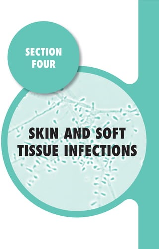 SKIN AND SOFT
TISSUE INFECTIONS
SECTION
FOUR
Gilligan_Sec4_255-306.indd 255 7/24/14 11:44 AM
 