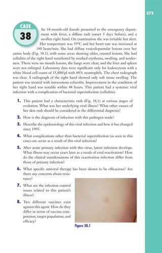 273
An 18-month-old female presented to the emergency depart-
ment with fever, a diffuse rash (onset 5 days before), and a
swollen right hand. On examination she was irritable but alert.
Her temperature was 39°C and her heart rate was increased at
180 beats/min. She had diffuse vesiculopustular lesions over her
entire body (Fig. 38.1), with some areas showing older, crusted lesions. She had
cellulitis of the right hand manifested by marked erythema, swelling, and tender-
ness. There were no mouth lesions, the lungs were clear, and the liver and spleen
were not enlarged. Laboratory data were significant only for leukocytosis with a
white blood cell count of 15,800/μl with 88% neutrophils. The chest radiograph
was clear. A radiograph of the right hand showed only soft tissue swelling. The
patient was treated with intravenous cefazolin. Improvement in the condition of
her right hand was notable within 48 hours. This patient had a systemic viral
infection with a complication of bacterial superinfection (cellulitis).
1. This patient had a characteristic rash (Fig. 38.1) at various stages of
evolution. What was her underlying viral illness? What other causes of
her skin rash should be considered in the differential diagnosis?
2. How is the diagnosis of infection with this pathogen made?
3. Describe the epidemiology of this viral infection and how it has changed
since 1995.
4. What complications other than bacterial superinfection (as seen in this
case) can occur as a result of this viral infection?
5. After acute primary infection with this virus, latent infection develops.
What illness may occur years later as a result of viral reactivation? How
do the clinical manifestations of this reactivation infection differ from
those of primary infection?
6. What specific antiviral therapy has been shown to be efficacious? Are
there any concerns about resis-
tance?
7. What are the infection control
issues related to this patient’s
illness?
8. Two different vaccines exist
against this agent. How do they
differ in terms of vaccine com-
position, target population, and
efficacy?
An 18-month-old female presented to the emergency depart-
swollen right hand. On examination she was irritable but alert.
Her temperature was 39°C and her heart rate was increased at
180 beats/min. She had diffuse vesiculopustular lesions over her
CASE
38
Figure 38.1
Gilligan_Sec4_255-306.indd 273 7/24/14 11:44 AM
 