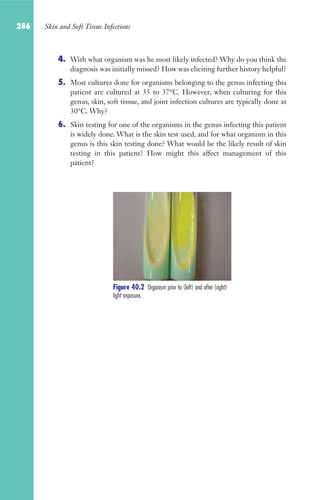 286 Skin and Soft Tissue Infections
4. With what organism was he most likely infected? Why do you think the
diagnosis was initially missed? How was eliciting further history helpful?
5. Most cultures done for organisms belonging to the genus infecting this
patient are cultured at 35 to 37°C. However, when culturing for this
genus, skin, soft tissue, and joint infection cultures are typically done at
30°C. Why?
6. Skin testing for one of the organisms in the genus infecting this patient
is widely done. What is the skin test used, and for what organism in this
genus is this skin testing done? What would be the likely result of skin
testing in this patient? How might this affect management of this
patient?
Figure 40.2 Organism prior to (left) and after (right)
light exposure.
Gilligan_Sec4_255-306.indd 286 7/24/14 11:44 AM
 