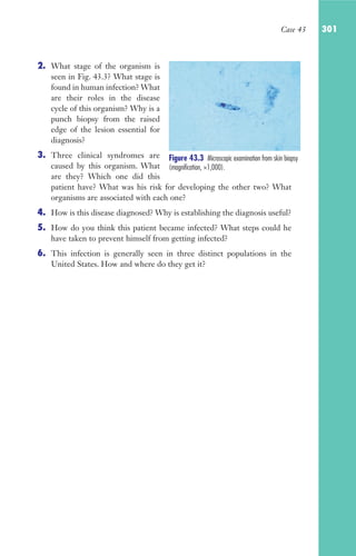 Case 43 301
2. What stage of the organism is
seen in Fig. 43.3? What stage is
found in human infection? What
are their roles in the disease
cycle of this organism? Why is a
punch biopsy from the raised
edge of the lesion essential for
diagnosis?
3. Three clinical syndromes are
caused by this organism. What
are they? Which one did this
patient have? What was his risk for developing the other two? What
organisms are associated with each one?
4. How is this disease diagnosed? Why is establishing the diagnosis useful?
5. How do you think this patient became infected? What steps could he
have taken to prevent himself from getting infected?
6. This infection is generally seen in three distinct populations in the
United States. How and where do they get it?
Figure 43.3 Microscopic examination from skin biopsy
(magnification, ×1,000).
Gilligan_Sec4_255-306.indd 301 7/24/14 11:44 AM
 