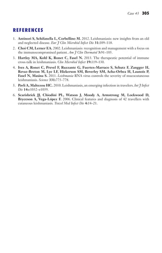 Case 43 305
REFERENCES
1. Antinori S, Schifanella L, Corbellino M. 2012. Leishmaniasis: new insights from an old
and neglected disease. Eur J Clin Microbiol Infect Dis 31:109–118.
2. Choi CM, Lerner EA. 2002. Leishmaniasis: recognition and management with a focus on
the immunocompromised patient. Am J Clin Dermatol 3:91–105.
3. Hartley MA, Kohl K, Ronet C, Fasel N. 2013. The therapeutic potential of immune
cross-talk in leishmaniasis. Clin Microbiol Infect 19:119–130.
4. Ives A, Ronet C, Prevel F, Ruzzante G, Fuertes-Marraco S, Schutz F, Zangger H,
Revaz-Breton M, Lye LF, Hickerson SM, Beverley SM, Acha-Orbea H, Launois P,
Fasel N, Masina S. 2011. Leishmania RNA virus controls the severity of mucocutaneous
leishmaniasis. Science 331:775–778.
5. Pavli A, Maltezou HC. 2010. Leishmaniasis, an emerging infection in travelers. Int J Infect
Dis 14:e1032–e1039.
6. Scarisbrick JJ, Chiodini PL, Watson J, Moody A, Armstrong M, Lockwood D,
Bryceson A, Vega-López F. 2006. Clinical features and diagnosis of 42 travellers with
cutaneous leishmaniasis. Travel Med Infect Dis 4:14–21.
Gilligan_Sec4_255-306.indd 305 7/24/14 11:44 AM
 