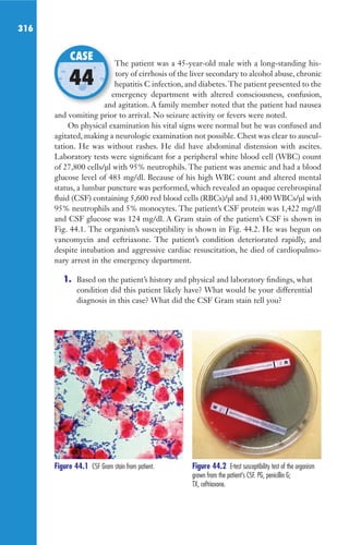 316
The patient was a 45-year-old male with a long-standing his-
tory of cirrhosis of the liver secondary to alcohol abuse, chronic
hepatitis C infection, and diabetes. The patient presented to the
emergency department with altered consciousness, confusion,
and agitation. A family member noted that the patient had nausea
and vomiting prior to arrival. No seizure activity or fevers were noted.
On physical examination his vital signs were normal but he was confused and
agitated, making a neurologic examination not possible. Chest was clear to auscul-
tation. He was without rashes. He did have abdominal distension with ascites.
Laboratory tests were significant for a peripheral white blood cell (WBC) count
of 27,800 cells/μl with 95% neutrophils. The patient was anemic and had a blood
glucose level of 483 mg/dl. Because of his high WBC count and altered mental
status, a lumbar puncture was performed, which revealed an opaque cerebrospinal
fluid (CSF) containing 5,600 red blood cells (RBCs)/μl and 31,400 WBCs/μl with
95% neutrophils and 5% monocytes. The patient’s CSF protein was 1,422 mg/dl
and CSF glucose was 124 mg/dl. A Gram stain of the patient’s CSF is shown in
Fig. 44.1. The organism’s susceptibility is shown in Fig. 44.2. He was begun on
vancomycin and ceftriaxone. The patient’s condition deteriorated rapidly, and
despite intubation and aggressive cardiac resuscitation, he died of cardiopulmo-
nary arrest in the emergency department.
1. Based on the patient’s history and physical and laboratory findings, what
condition did this patient likely have? What would be your differential
diagnosis in this case? What did the CSF Gram stain tell you?
The patient was a 45-year-old male with a long-standing his-
hepatitis C infection, and diabetes. The patient presented to the
emergency department with altered consciousness, confusion,
and agitation. A family member noted that the patient had nausea
CASE
44
Figure 44.1 CSF Gram stain from patient. Figure 44.2 E-test susceptibility test of the organism
grown from the patient’s CSF. PG, penicillin G;
TX, ceftriaxone.
Gilligan_Sec5_307-368.indd 316 7/24/14 11:46 AM
 