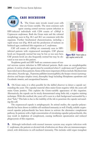 344 Central Nervous System Infections
CASE DISCUSSION
1. The Gram stain reveals round yeast cells
that are Gram variable. The most common such
agent causing central nervous system infection in
HIV-infected individuals with CD4 counts of 200/μl is
Cryptococcus neoformans. Both the Gram stain and the colonial
morphology seen in Fig. 48.1 and 48.2 are consistent with this
organism. Further biochemical characterization, including a
rapid urease test (Fig. 48.4) and the production of melanin on
birdseed agar, confirmed this organism as C. neoformans.
CSF cell counts of 100/μl are commonly seen in HIV-
infected patients with cryptococcal meningitis. CSF glucose
levels are frequently normal but may be low as was seen here.
CSF protein levels are also frequently normal but may be ele-
vated as was seen in this patient.
Toxoplasma gondii and HIV both are common causes of cen-
tral nervous system infection in HIV-infected patients. Both cause an encephalopathic
picture.A variety of other agents must be considered when C. neoformans and T. gondii have
been ruled out in these patients.Some of the more important of these include Mycobacterium
tuberculosis, Nocardia spp., Treponema pallidum (neurosyphilis), the herpes viruses (cytomeg-
alovirus and herpes simplex virus), dimorphic fungi including Histoplasma capsulatum and
Coccidioides immitis, and encapsulated bacteria.
2. On Gram stain, it is often possible for the skilled observer to detect a capsule sur-
rounding the yeast. The capsular material often stains Gram negative while the yeast cell
stains Gram positive. This explains the Gram-variable appearance of this organism.
Alternatively, the capsule can be nicely demonstrated using India ink, a negative staining
technique. With this method, the yeast cell is seen in a dark background surrounded by a
clear “halo.” This halo is due to the inability of the ink to penetrate the capsule surround-
ing the cell.
The cryptococcal capsule is antiphagocytic. In animal studies, the capsular polysac-
charide has been shown to inhibit cell-mediated immunity as well. Finally, soluble crypto-
coccal capsular polysaccharide has been shown to activate the alternative complement
pathway. In patients with a high concentration of circulating capsular polysaccharide, this
may result in depletion of complement, causing inefficient opsonization and reduced
phagocytosis of this organism.
3. Although individuals with normal immune systems may acquire infection with
C. neoformans, the patients at elevated risk of infection are those who are immunocompro-
mised, with deficiencies in cell-mediated immunity. This includes solid organ transplant
agent causing central nervous system infection in
CASE
48
Figure 48.4 Patient isolate on
right; negative control on left.
Gilligan_Sec5_307-368.indd 344 7/24/14 11:46 AM
 