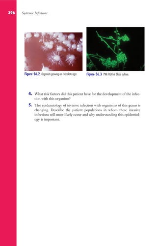 396 Systemic Infections
4. What risk factors did this patient have for the development of the infec-
tion with this organism?
5. The epidemiology of invasive infection with organisms of this genus is
changing. Describe the patient populations in whom these invasive
infections will most likely occur and why understanding this epidemiol-
ogy is important.
Figure 56.3 PNA FISH of blood culture.
Figure 56.2 Organism growing on chocolate agar.
Gilligan_Sec6_369-436.indd 396 7/24/14 11:14 AM
 