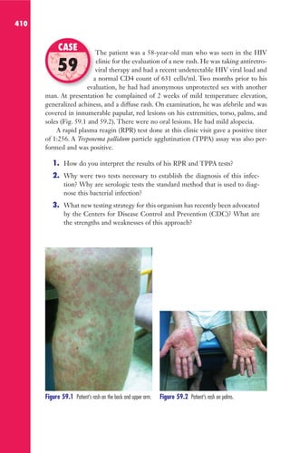 410
The patient was a 58-year-old man who was seen in the HIV
clinic for the evaluation of a new rash. He was taking antiretro-
viral therapy and had a recent undetectable HIV viral load and
a normal CD4 count of 631 cells/ml. Two months prior to his
evaluation, he had had anonymous unprotected sex with another
man. At presentation he complained of 2 weeks of mild temperature elevation,
generalized achiness, and a diffuse rash. On examination, he was afebrile and was
covered in innumerable papular, red lesions on his extremities, torso, palms, and
soles (Fig. 59.1 and 59.2). There were no oral lesions. He had mild alopecia.
A rapid plasma reagin (RPR) test done at this clinic visit gave a positive titer
of 1:256. A Treponema pallidum particle agglutination (TPPA) assay was also per-
formed and was positive.
1. How do you interpret the results of his RPR and TPPA tests?
2. Why were two tests necessary to establish the diagnosis of this infec-
tion? Why are serologic tests the standard method that is used to diag-
nose this bacterial infection?
3. What new testing strategy for this organism has recently been advocated
by the Centers for Disease Control and Prevention (CDC)? What are
the strengths and weaknesses of this approach?
The patient was a 58-year-old man who was seen in the HIV
viral therapy and had a recent undetectable HIV viral load and
a normal CD4 count of 631 cells/ml. Two months prior to his
evaluation, he had had anonymous unprotected sex with another
CASE
59
Figure 59.1 Patient’s rash on the back and upper arm. Figure 59.2 Patient’s rash on palms.
Gilligan_Sec6_369-436.indd 410 7/24/14 11:14 AM
 
