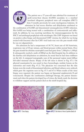 CASOS CLINICOS_MICROBIOLOGÍA.pdf