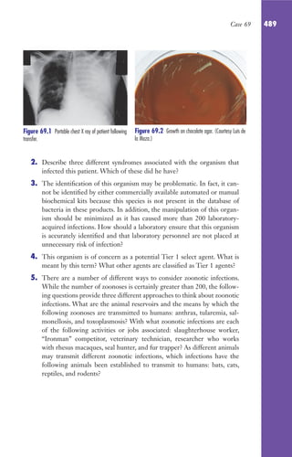 CASOS CLINICOS_MICROBIOLOGÍA.pdf