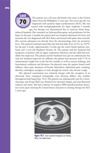 CASOS CLINICOS_MICROBIOLOGÍA.pdf