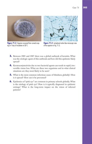 CASOS CLINICOS_MICROBIOLOGÍA.pdf