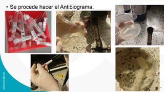 • Se procede hacer el Antibiograma.
 