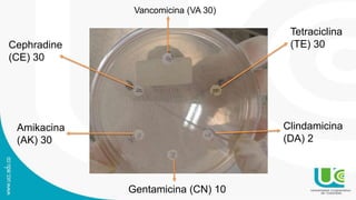 Vancomicina (VA 30)
Tetraciclina
(TE) 30
Clindamicina
(DA) 2
Cephradine
(CE) 30
Amikacina
(AK) 30
Gentamicina (CN) 10
 