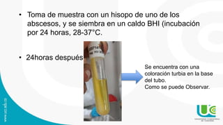• Toma de muestra con un hisopo de uno de los
abscesos, y se siembra en un caldo BHI (incubación
por 24 horas, 28-37°C.
• 24horas después
Se encuentra con una
coloración turbia en la base
del tubo.
Como se puede Observar.
 