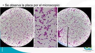• Se observa la placa por el microscopio:
 