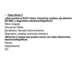 • Caso clínico 3
¿Qué muestra el ECG? (ritmo, frecuencia cardiaca, eje eléctrico
del QRS, y diagnóstico electrocardiográfico)?
Ritmo: irregular
Frecuencia:100lpm
Eje eléctrico: desviado hacia la derecha
Diagnostico: complejo ventricular prematuro
Mencione 3 causas que puedan cursar con estas alteraciones
electrocardiográficas.
Hipoxia
Hipopotasemia
ICC
 
